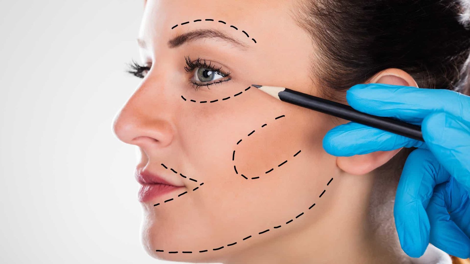 Planejamento de harmonização facial